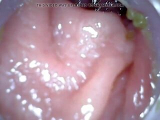 Anal endoscope parte 1, gratis enema castigo hd x calificación vídeo 04